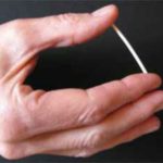 implante-anticonceptivo-control-distancia-varillaimplante-bbva