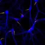 Imagen de neuronas. The Journal of Cell Biology (Creative Commons)