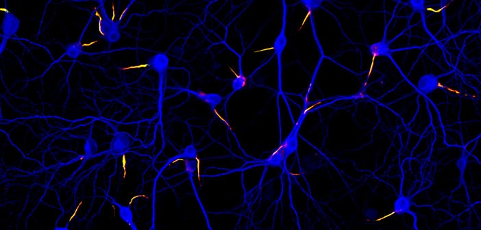 Imagen de neuronas. The Journal of Cell Biology (Creative Commons) Imagen de neuronas. The Journal of Cell Biology (Creative Commons)