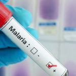 Fotografia de vacuna malaria paludismo obligatoria america turismo viajar bbva