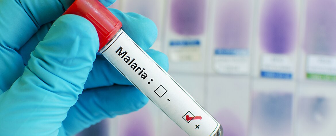 vacuna malaria paludismo obligatoria america turismo viajar Fotografia de vacuna malaria paludismo obligatoria america turismo viajar bbva