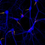 Neurons The Journal of Cell Biology (Creative Commons)