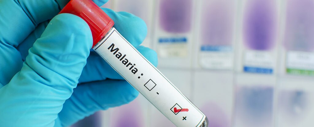 vaccination malaria mosquito america travel tourism picture of vaccination malaria mosquito america travel tourism bbva